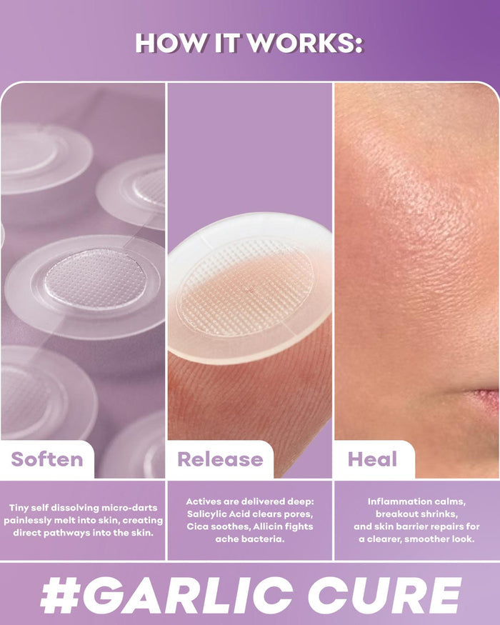 Diagram showing the process of 'Garlic Cure' with steps to soften, release, and heal skin.