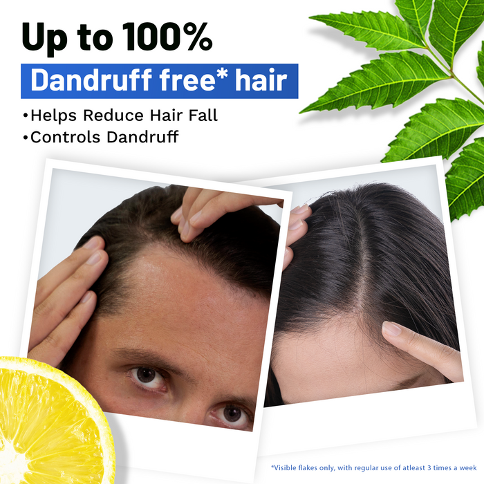 Ayurvedic Anti Dandruff Shampoo - 500ml
