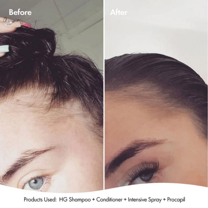 Bondi Boost Anti-Thinning Intensive Scalp Spray