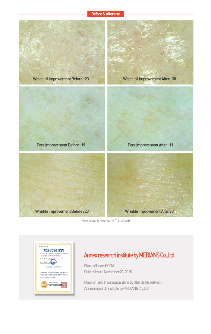 HYDROGEL REGENERATING  CENTELLA CREAM (Sleeping Pack) - HistoLab Canada