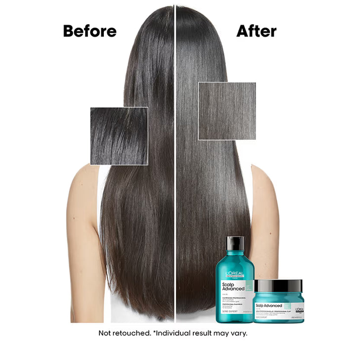 L’Oréal Professionnel Scalp Advanced Anti-Oiliness Dermo-Purifier Shampoo-for Oily Scalps(300ML)