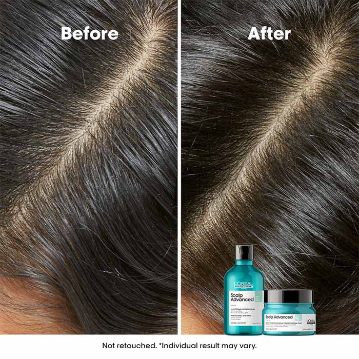 L’Oréal Professionnel Scalp Advanced Anti-Oiliness Dermo-Purifier Shampoo-for Oily Scalps(300ML)