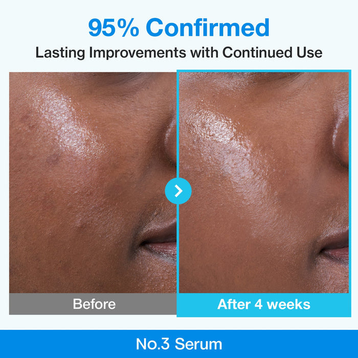 Numbuzin No.3 Blue Bio-Retinol Pore Refining Serum 30ml - DOKAN