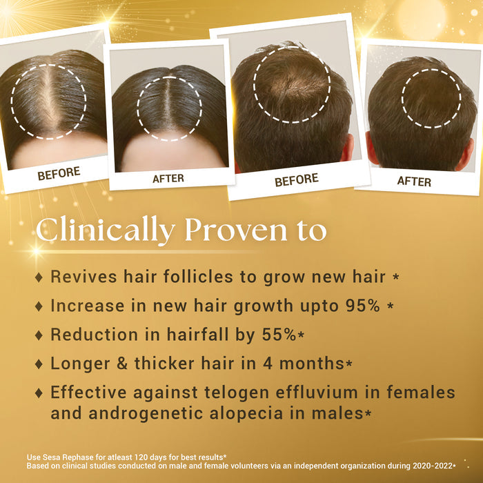 Rephase 2 Step Hair Growth Kit (Oil + Massager)