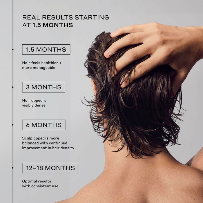 Zenagen Men's Revolve Shampoo and Conditioner results timeline infographic showing progress milestones from 1.5 months to optimal results at 12–18 months for healthier feel, visible hair density, and a balanced scalp with consistent use.