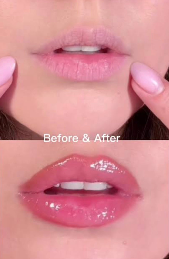 VT COSMETICS Reedle Shot Lip Plumper #Roseberry